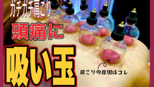 福岡の整骨院がする吸い玉の施術雰囲気